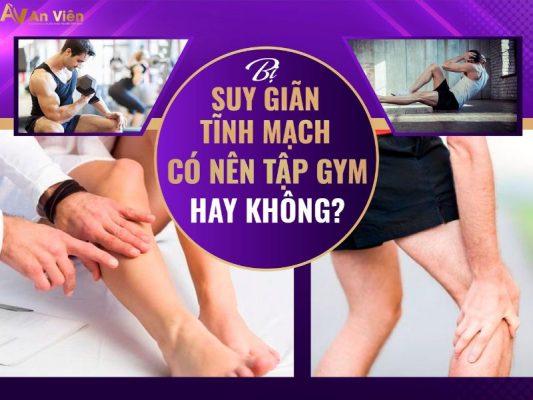 giãn tĩnh mạch có tập gym được không