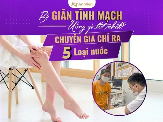 giãn tĩnh mạch uống gì