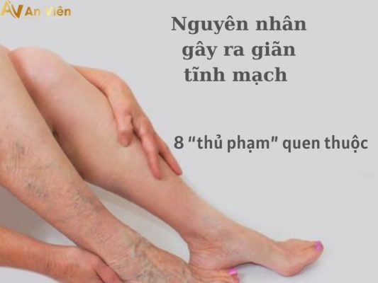nguyên nhân gây ra giãn tĩnh mạch