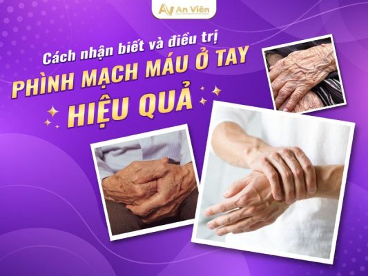 Phình mạch máu ở tay
