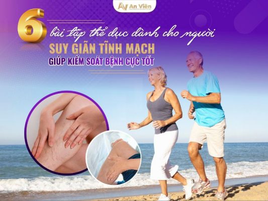 tập thể dục suy giãn tĩnh mạch