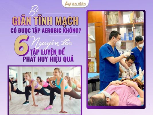 bị giãn tĩnh mạch có được tập aerobic không