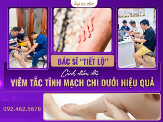 cách điều trị viêm tắc tĩnh mạch chi dưới
