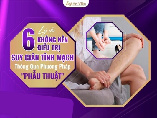 phẫu thuật giãn tĩnh mạch chân