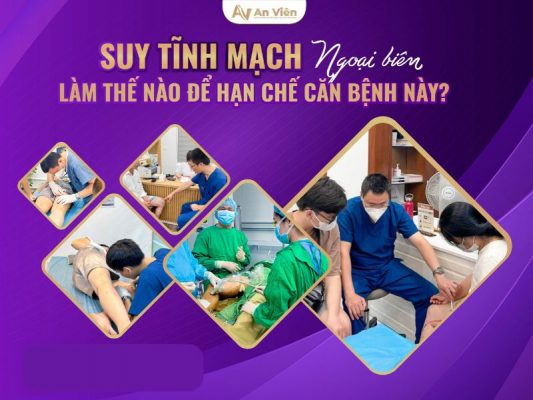 suy tĩnh mạch ngoại biên