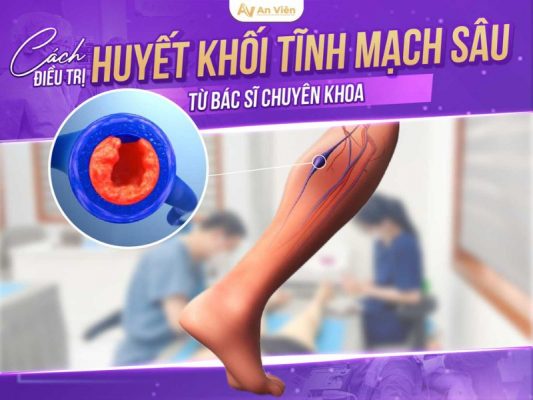 cách điều trị huyết khối tĩnh mạch