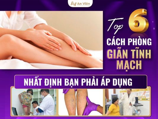 phòng giãn tĩnh mạch