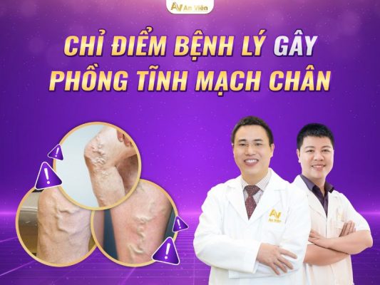 phồng tĩnh mạch chân