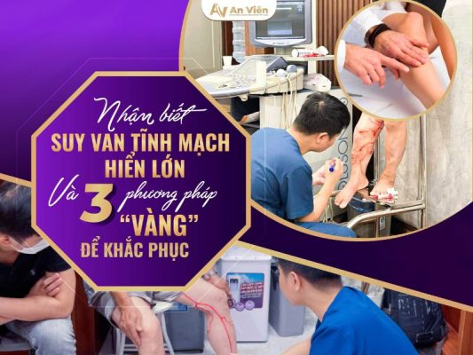 suy van tĩnh mạch hiển lớn là gì
