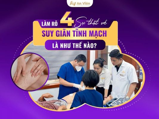 bệnh giãn tĩnh mạch là như thế nào