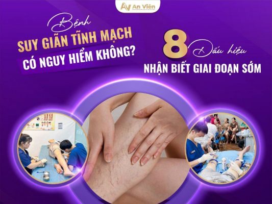 bệnh suy giãn tĩnh mạch có nguy hiểm không