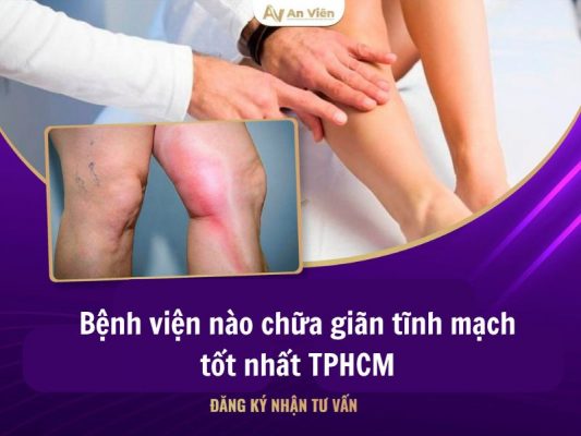 bệnh viện nào chữa giãn tĩnh mạch tốt nhất TPHCM