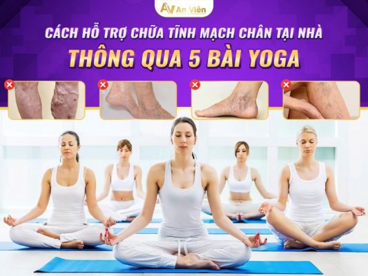 cách chữa tĩnh mạch chân