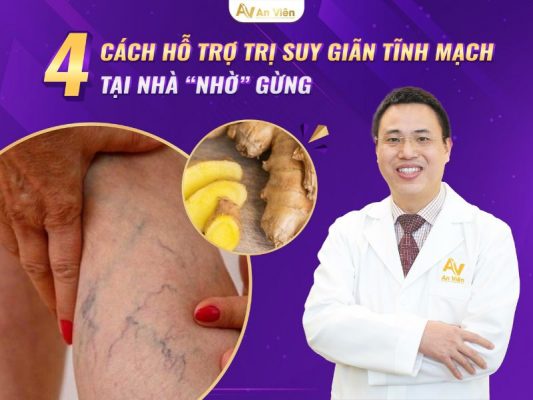 cách điều trị suy giãn tĩnh mạch tại nhà