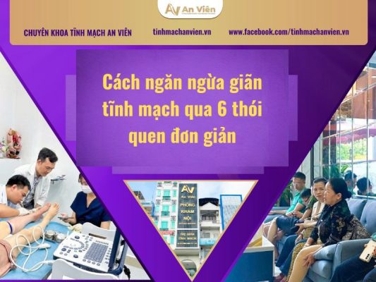 cách ngăn ngừa giãn tĩnh mạch