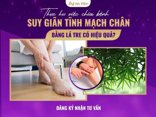 chữa bệnh suy giãn tĩnh mạch chân