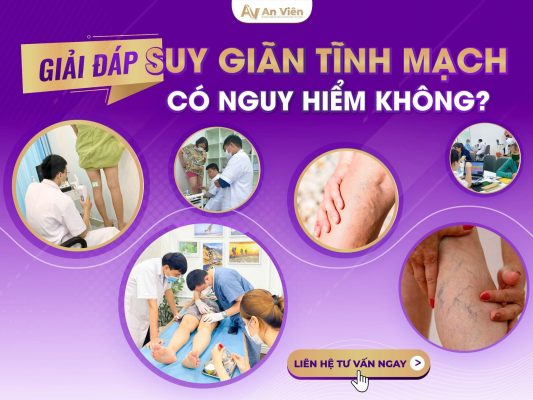giãn tĩnh mạch chân có nguy hiểm không