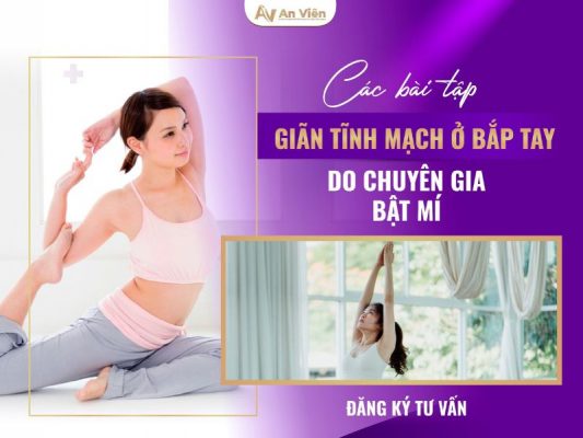 giãn tĩnh mạch ở bắp tay