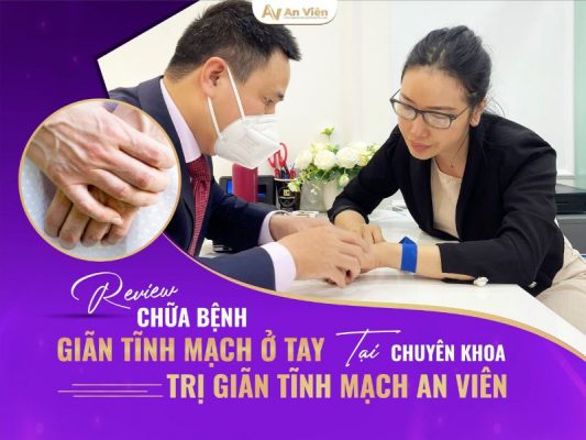 giãn tĩnh mạch ở tay