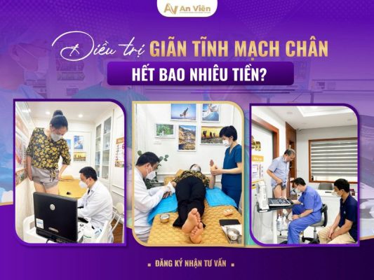 mổ giãn tĩnh mạch chân hết bao nhiêu tiền
