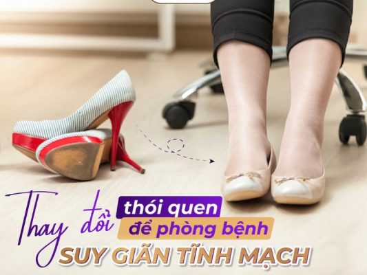 nguyên nhân của bệnh giãn tĩnh mạch