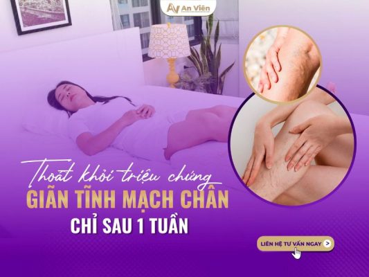 triệu chứng giãn tĩnh mạch chântriệu chứng giãn tĩnh mạch chân