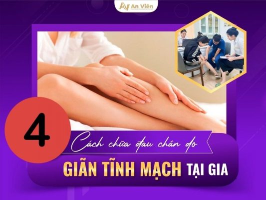 cách điều trị giãn tĩnh mạch chân tại nhà