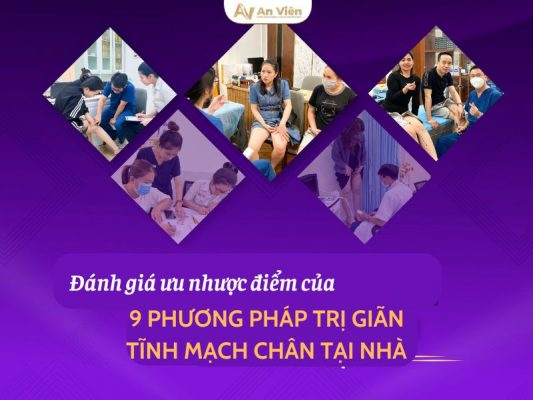 cách điều trị giãn tĩnh mạch chân tại nhà