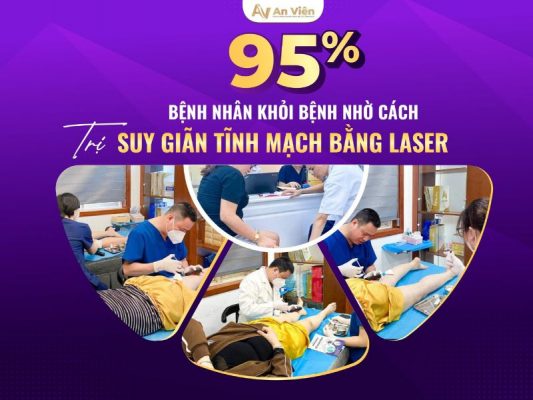 cách trị suy giãn tĩnh mạch