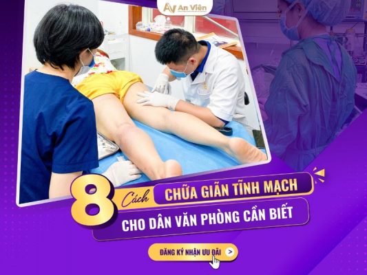 chữa suy giãn tĩnh mạch chân