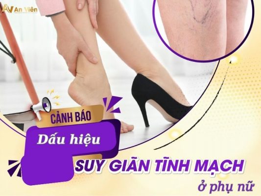 dấu hiệu của suy giãn tĩnh mạch chân