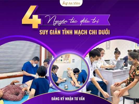 điều trị suy giãn tĩnh mạch chi dưới