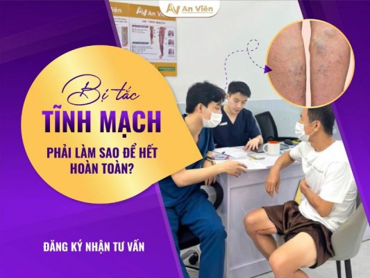 bị tắc tĩnh mạch chân phải làm sao