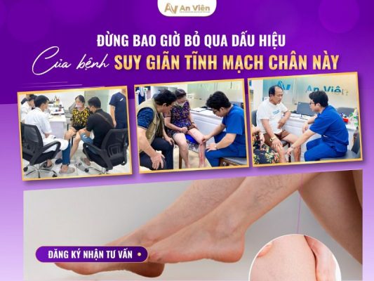 dấu hiệu bị giãn tĩnh mạch chân