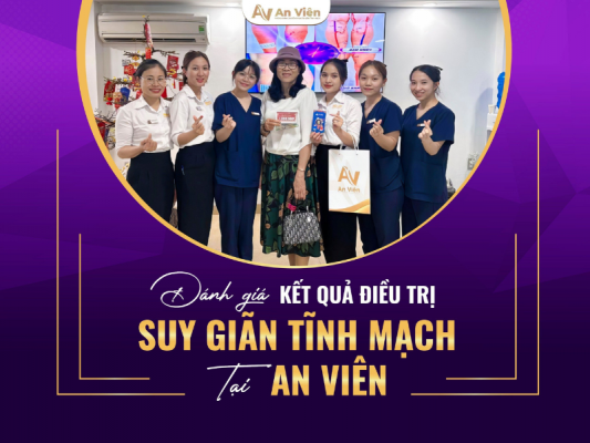 điều trị giãn tĩnh mạch chi dưới