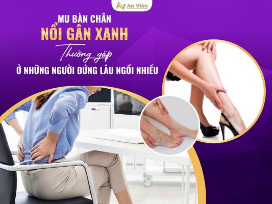 mu bàn chân nổi gân xanh
