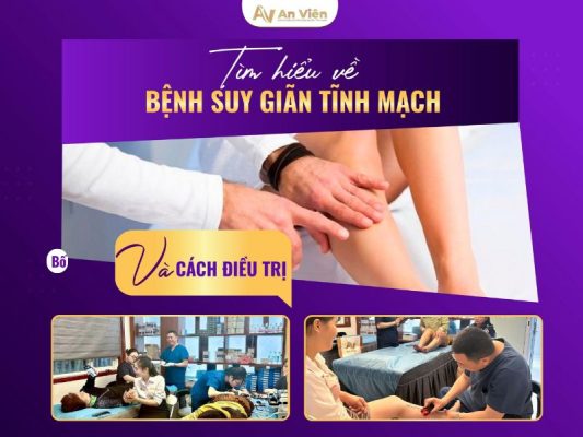 bệnh giãn tĩnh mạch và cách điều trị