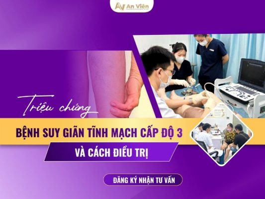bệnh suy giảm tĩnh mạch