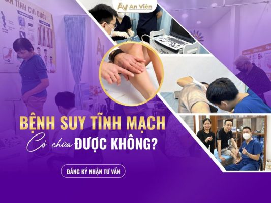 bệnh suy tĩnh mạch có chữa được không