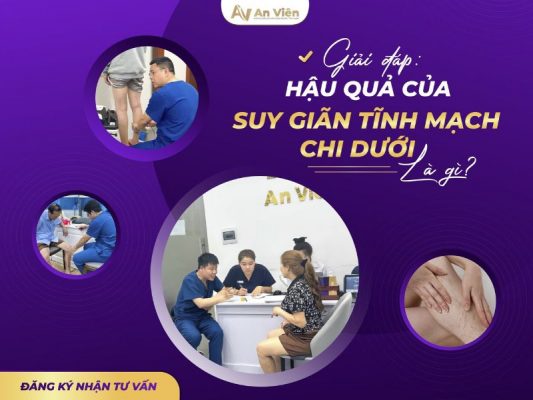 bị giãn tĩnh mạch chân có sao không