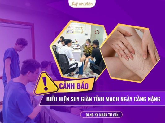 biểu hiện giãn tĩnh mạch ở chân