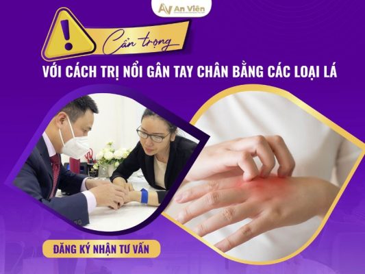 cách trị nổi gân tay chân
