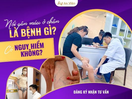 chân bị nổi mạch máu đỏ