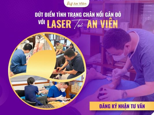 chân bị nổi gân đỏ