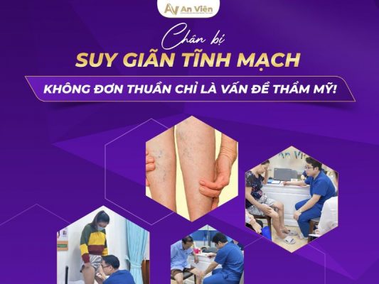 chân bị suy giãn tĩnh mạch