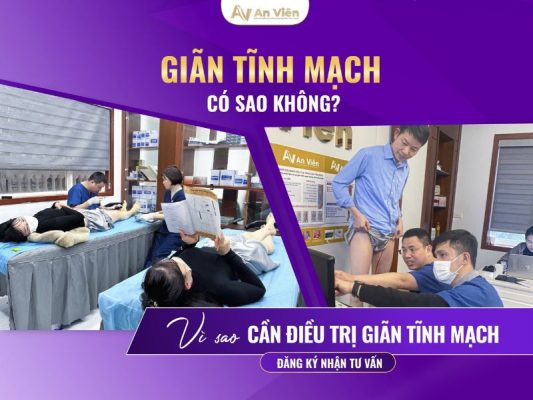 giãn tĩnh mạch có sao không