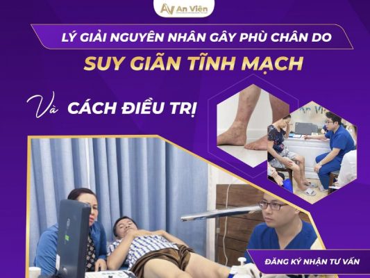 phù chân do suy giãn tĩnh mạch