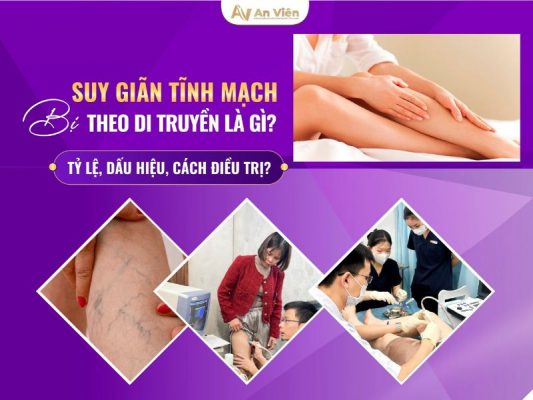 suy tĩnh mạch là gì