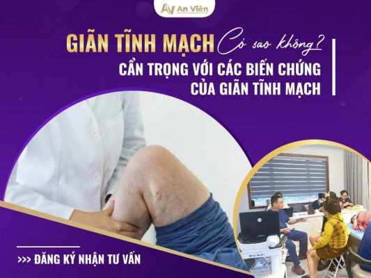 bị giãn tĩnh mạch có sao không