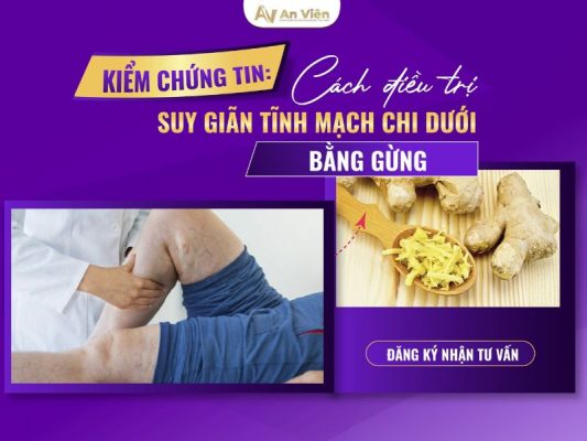 cách điều trị giãn tĩnh mạch chi dưới
